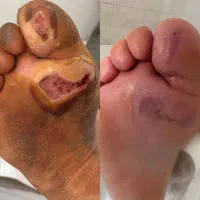 کلینیک تخصصی درمان انواع زخم(بستر و دیابت) فردوس