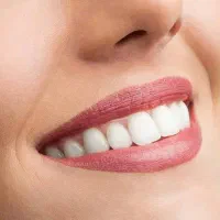 اگر امروز به دندانهایت توجه نکنی فردا دیره|خدمات آرایشگری و زیبایی|رفسنجان, |دیوار