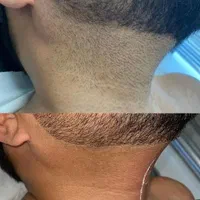 لیزر خط ریش وپشت گردن وموهای زائدگوش۱۹۰تومن|خدمات آرایشگری و زیبایی|قم, حنیف نژاد|دیوار