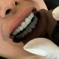 دندانپزشکی زیبایی و درمانی