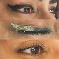 ریموابرو چشم و ریمو‌اورژانسی بایک جلسه  فقط ۳۸۰۰