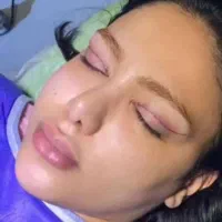 لیفت شقیقه ،بلفارو ،غبغب وغیره|خدمات آرایشگری و زیبایی|اهواز, کیانپارس |دیوار