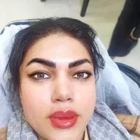تخفیف ویژه زیبا جویان ژل ۴۰۰بوتاکس۳۰۰فقط یک هفته|خدمات آرایشگری و زیبایی|اصفهان, شهشهان|دیوار