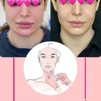 کلینیک زیبایی هیوا|خدمات آرایشگری و زیبایی|شاهین‌شهر, حافظ جنوبی|دیوار