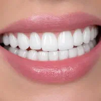 کامپوزیت دندان عصبکشی روکش دندانپزشکی تهرانسر|خدمات زیبایی و سلامت|تهران, تهرانسر مرکزی|دیوار