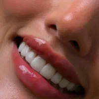 کامپوزیت ونیر|خدمات آرایشگری و زیبایی|قم, سالاریه|دیوار