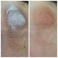 دکتر پا ،درمانگر ناخن و پوست|خدمات آرایشگری و زیبایی|یاسوج, |دیوار
