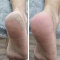 اپیلاسیون کل بدن ۵۵۰ اموزش ۱۸۰۰ فقط پدیکور ۵۰۰|خدمات آموزشی|زاهدان, |دیوار