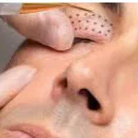 کارپاکسازی صورت وپلاسماتراپی|خدمات آرایشگری و زیبایی|اصفهان, ارزنان|دیوار