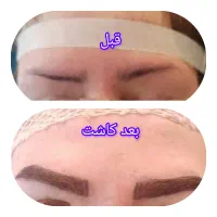 زیبایی ،پوست ،جراحی|خدمات آرایشگری و زیبایی|سهند, |دیوار