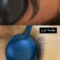 خدمات ریمو تتو،رفع کک و مک کلینک دکتر شریفی|خدمات آرایشگری و زیبایی|فولادشهر, B4|دیوار