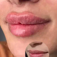 تزریق ژل و بوتاکس و جوانساز|خدمات آرایشگری و زیبایی|تهران, کیانشهر|دیوار