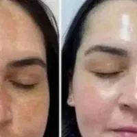 لوازم درءمان ککمک . تنکی . واژ . ُسواِِل آییننامه