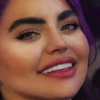 کامپوزیت/لمینیت/عصب کشی/روکش طلا