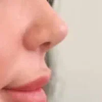 دکترجراجی بینی معرفی کنین