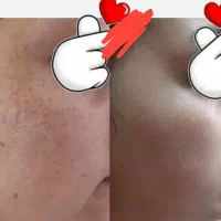 پوست زیبا و بدون آرایش|آرایشی، بهداشتی، درمانی|اهواز, منازل کارون|دیوار