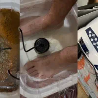 درمان انواع بیماریها