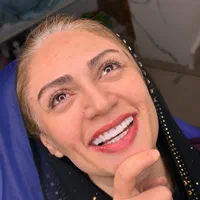 کامپوزیت دندان به مناسبت ۴ ساله شدنمون از واحدی۶۰۰|خدمات آرایشگری و زیبایی|فردیس, منظریه|دیوار