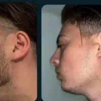 ریشات مثل فولاد زخیم میشه