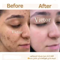 کرم فوقالعاده قوی ویکتور قیمت یک میلیون .