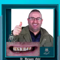 دندانپزشکی ترمیم دندان با مواد کامپوزیت دندان|خدمات آرایشگری و زیبایی|شیراز, معالی‌آباد|دیوار