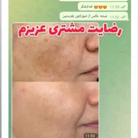 صابون لایه بردار گیاهی روشن کننده صورت وبدن|آرایشی، بهداشتی، درمانی|اهواز, آریاشهر|دیوار