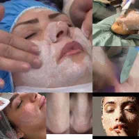 پاکسازی تخصصی پوست