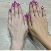 کرم شیرالاغ سفیدکننده