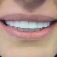 دندان پزشکی و کامپوزیت دندان در یاسوج|خدمات آرایشگری و زیبایی|دوگنبدان, |دیوار