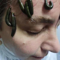 حجامت مرکزی اصفهان،زالو‌ درمانی میگرن واریس فصدprp|خدمات آرایشگری و زیبایی|اصفهان, مسجد مصلی|دیوار