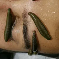 حجامت،فصد،زالو|خدمات آرایشگری و زیبایی|یاسوج, |دیوار