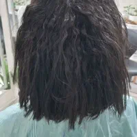 درمان قطعی موخوره و ریزش مو رایگان شد.|خدمات آرایشگری و زیبایی|رشت, کوی بیانی|دیوار