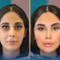 آف پکیجPRO FACE پزشک پوست مو بینی ابرو غبغب زیبایی