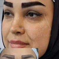 کاشت ابرو تخصصی در درمانگاه معتبر|خدمات آرایشگری و زیبایی|اهواز, زیتون کارمندی|دیوار