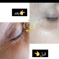فیشال و پاکسازی پوست زیر نظر متخصص پوست