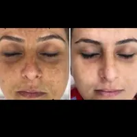 آموزش اسکالپ کف سر و فشیال پوست و کراتین ابریشمی|خدمات آموزشی|خمینی‌شهر, |دیوار