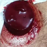 حجامت