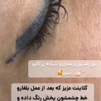 ریموو ریمو ابرو خط چشم پاک کردن رفع قرمزی|خدمات آرایشگری و زیبایی|شاهین‌شهر, عطار|دیوار