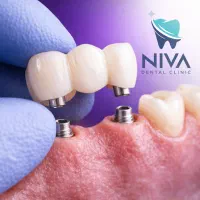 دندانپزشکی نیوا|خدمات آرایشگری و زیبایی|تهران, اختیاریه|دیوار