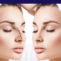 عمل زیبایی بینی فقط با 200 تومان