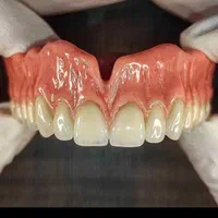 دندانسازی مروارید ثابت و متحرک|خدمات آرایشگری و زیبایی|کرج, خرمدشت|دیوار