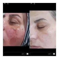 پوست و مو|آرایشی، بهداشتی، درمانی|زبرخان, |دیوار