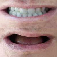 دندانسازی،دندان مصنوعی،جوان پسند،اقساطی با چک|خدمات آرایشگری و زیبایی|مشهد, شاهد (شهرک غرب)|دیوار