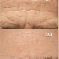 محصولات گیاهی مراقبتی پوست و مو