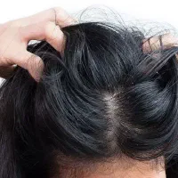 خارش و شوره دیگه کافیه