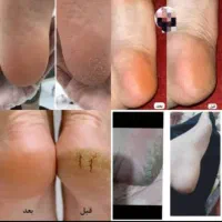 خوراکی|آرایشی، بهداشتی، درمانی|اهواز, کوی رمضان|دیوار