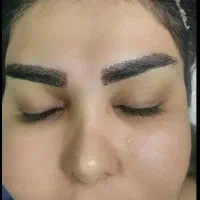 کاشت ابرو