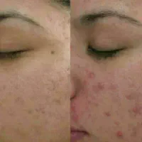 پاکسازی کبد با طبیعت