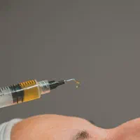 تخفیف ویژه پی ار پی و مزو سر و صورت|خدمات آرایشگری و زیبایی|تهران, امام حسین|دیوار