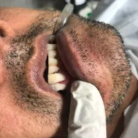 دندان پزشکی دندان سازی|خدمات آرایشگری و زیبایی|قائم‌شهر, |دیوار